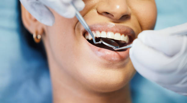 Best Emergency Denture Repair in Winter Beach, FL