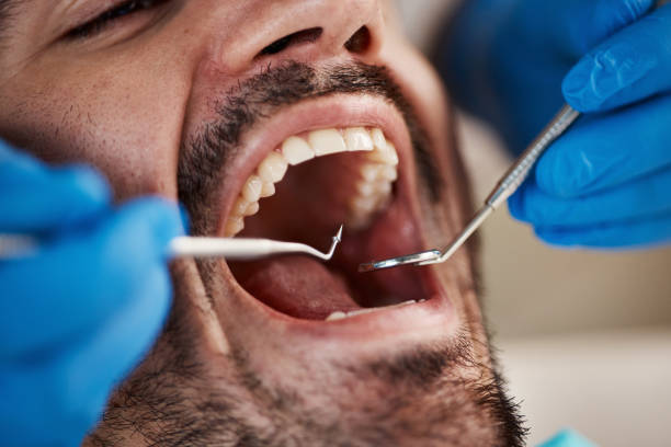 Best Emergency Cosmetic Dentistry (e.g., broken veneers) in Winter Beach, FL